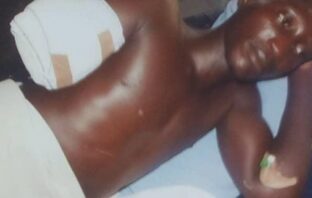 Suspected herdsmen cut off farmer’s hand, rape 2 ladies in Oyo
